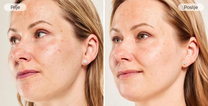 ES_3371_PDP_ISDINCEUTICSMELACLEAR1-80ML_BEFOREAFTER